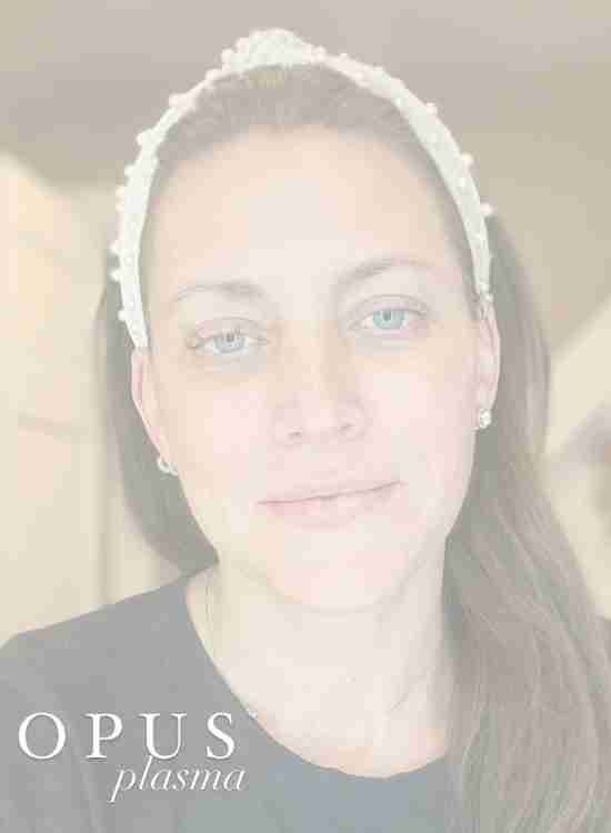 My Experience with OPUS PLASMA