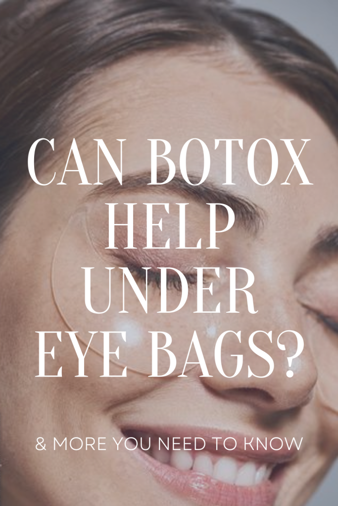 Can Botox Help Under Eye Bags?