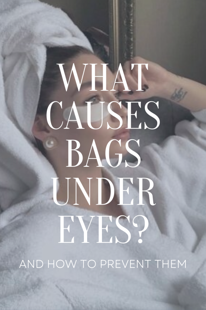 What Causes Bags Under Eyes